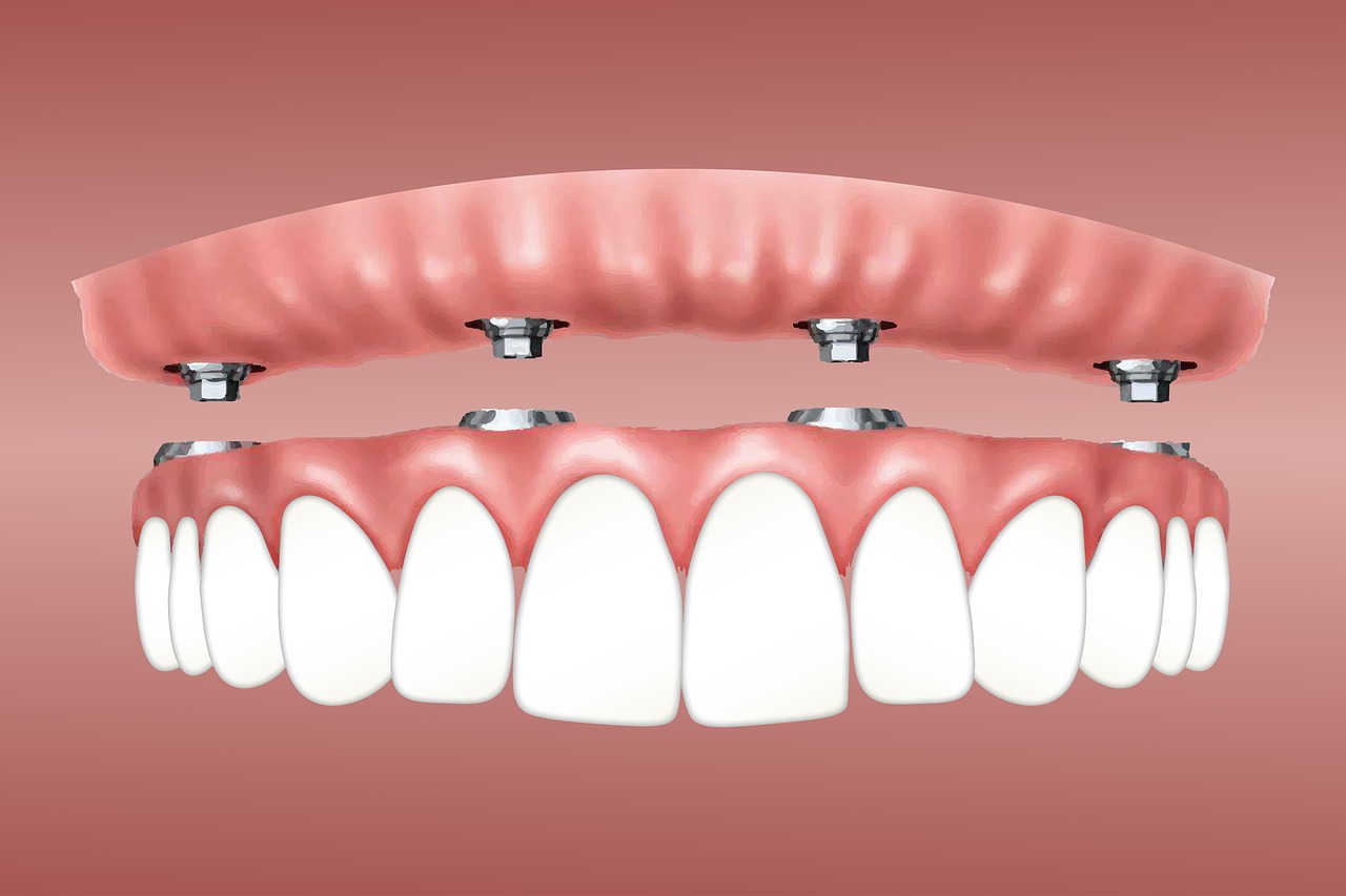 Kto i kiedy powinien korzystać z leczenia ortodontycznego? Aparat ortodontyczny Wrocław